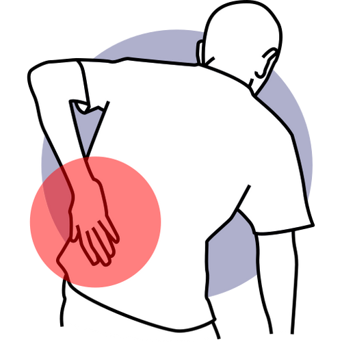 Lower-Back Stiffness
